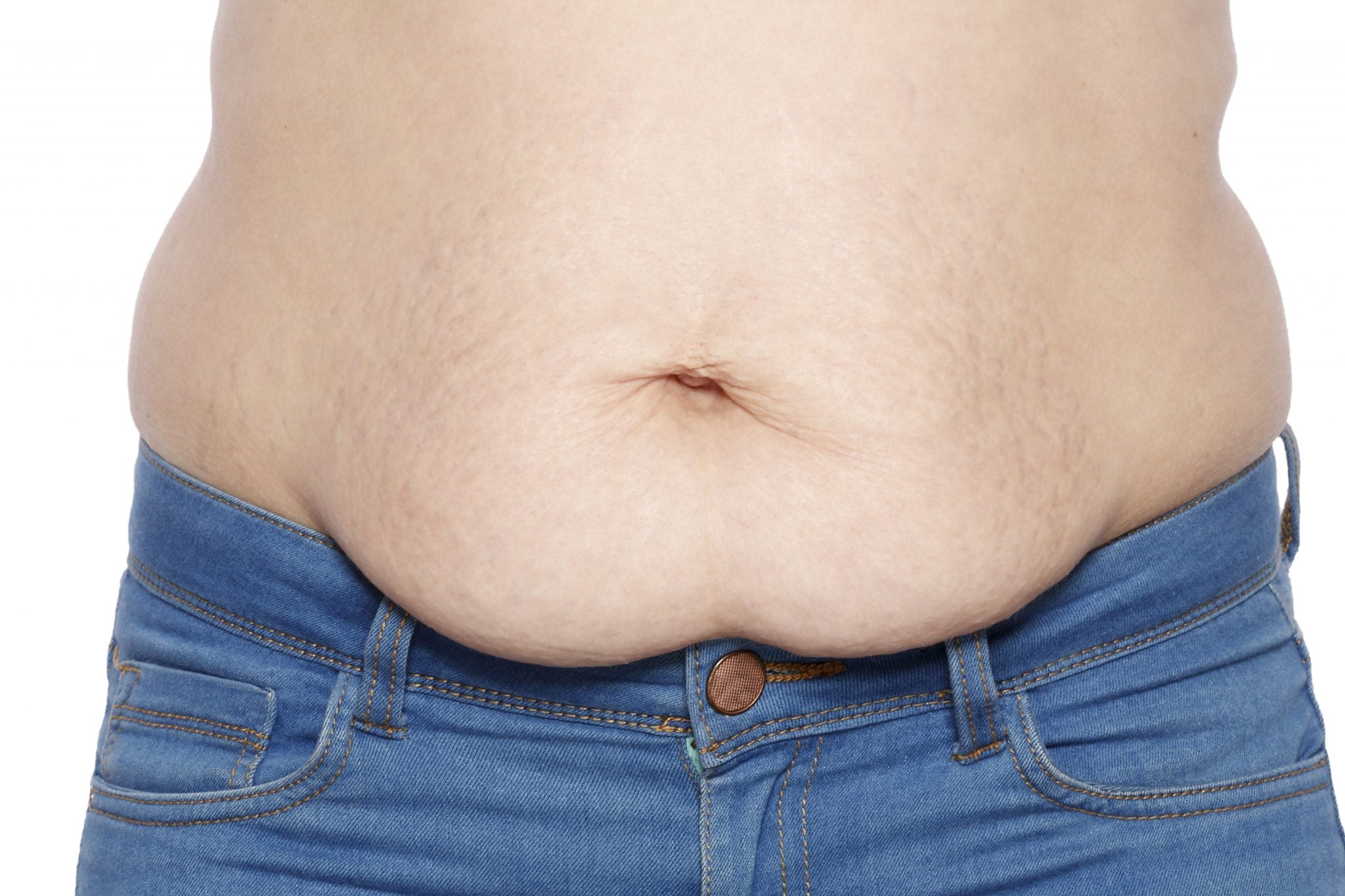 Stomach Protrusions With Sit-Ups: Causes, Treatments and